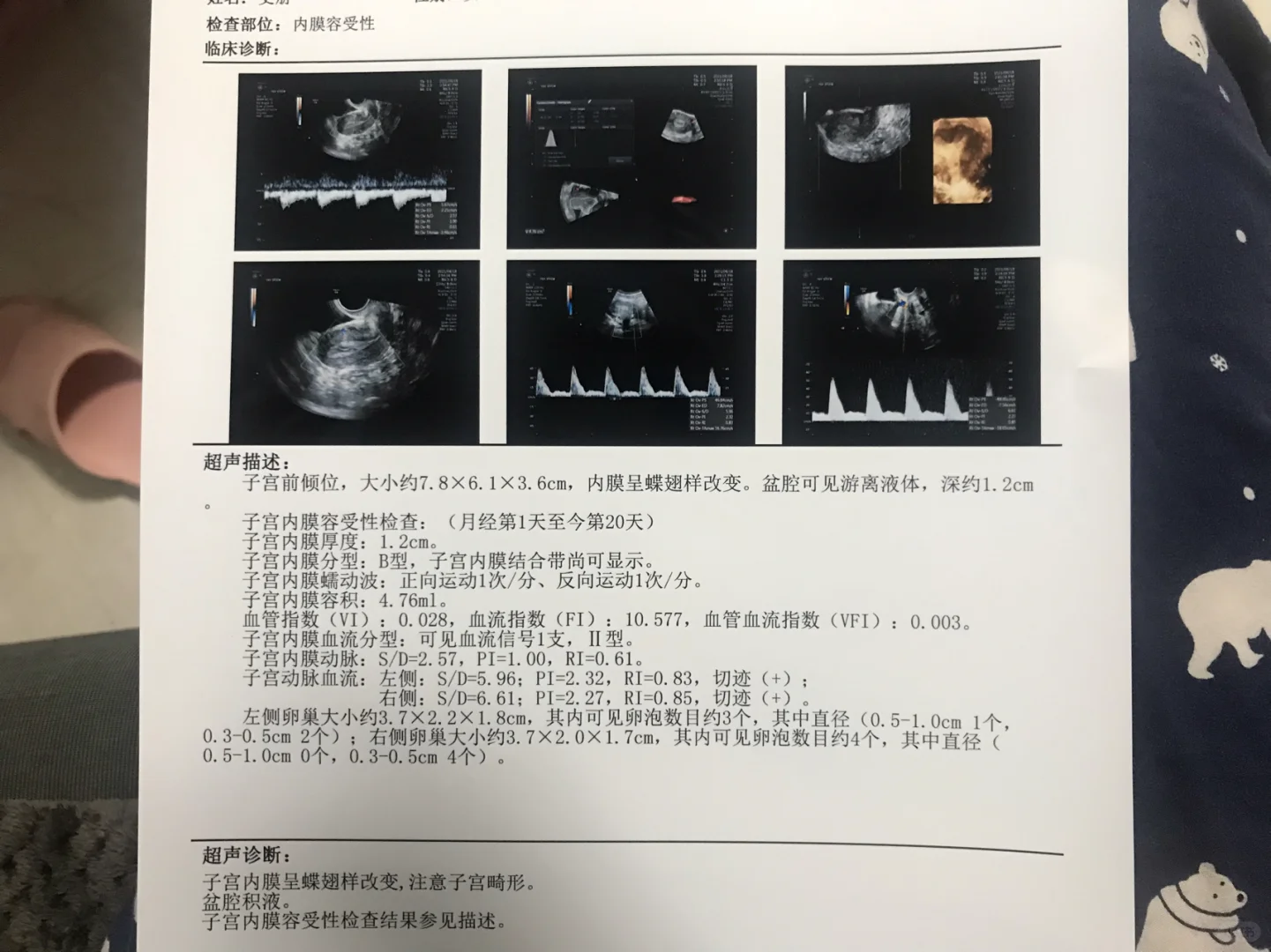 第一次胎停检查——子宫内膜容受,代孕套餐中心，哪里代孕机构最便宜